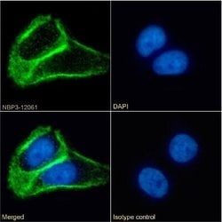 TSPAN1 Rabbit anti-Human, Clone: 2022-04-12 00:00:00, Novus Biologicals:Antibodies:Primary
